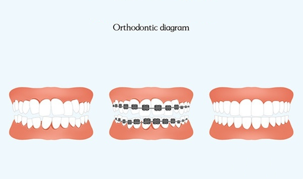 Orthodontic diagram